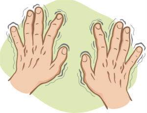 Stages of Parkinson's Disease- Tremors